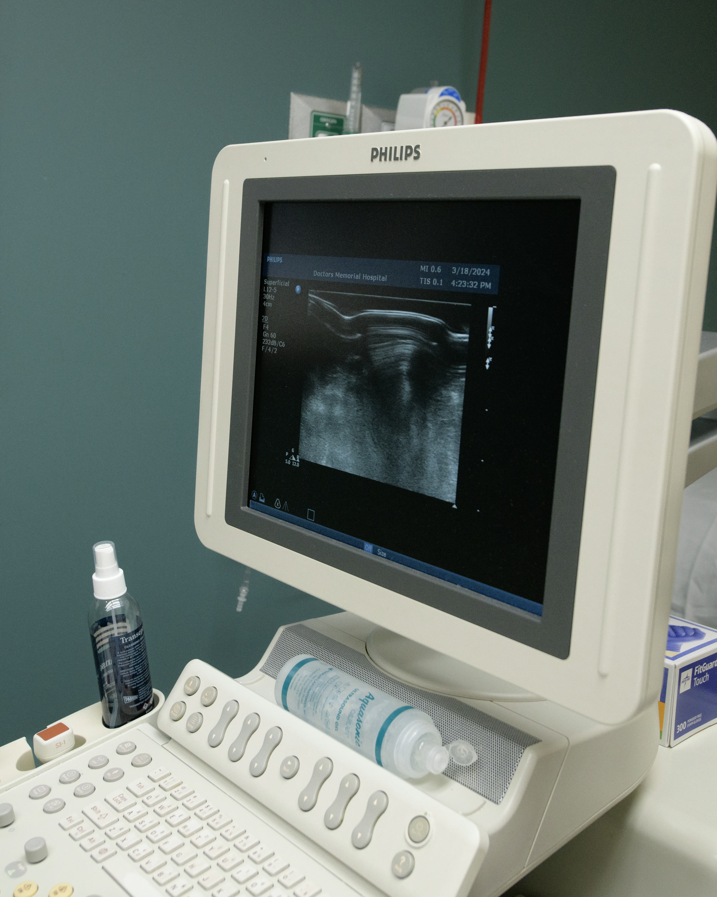 An ultrasound machine in an examination room
