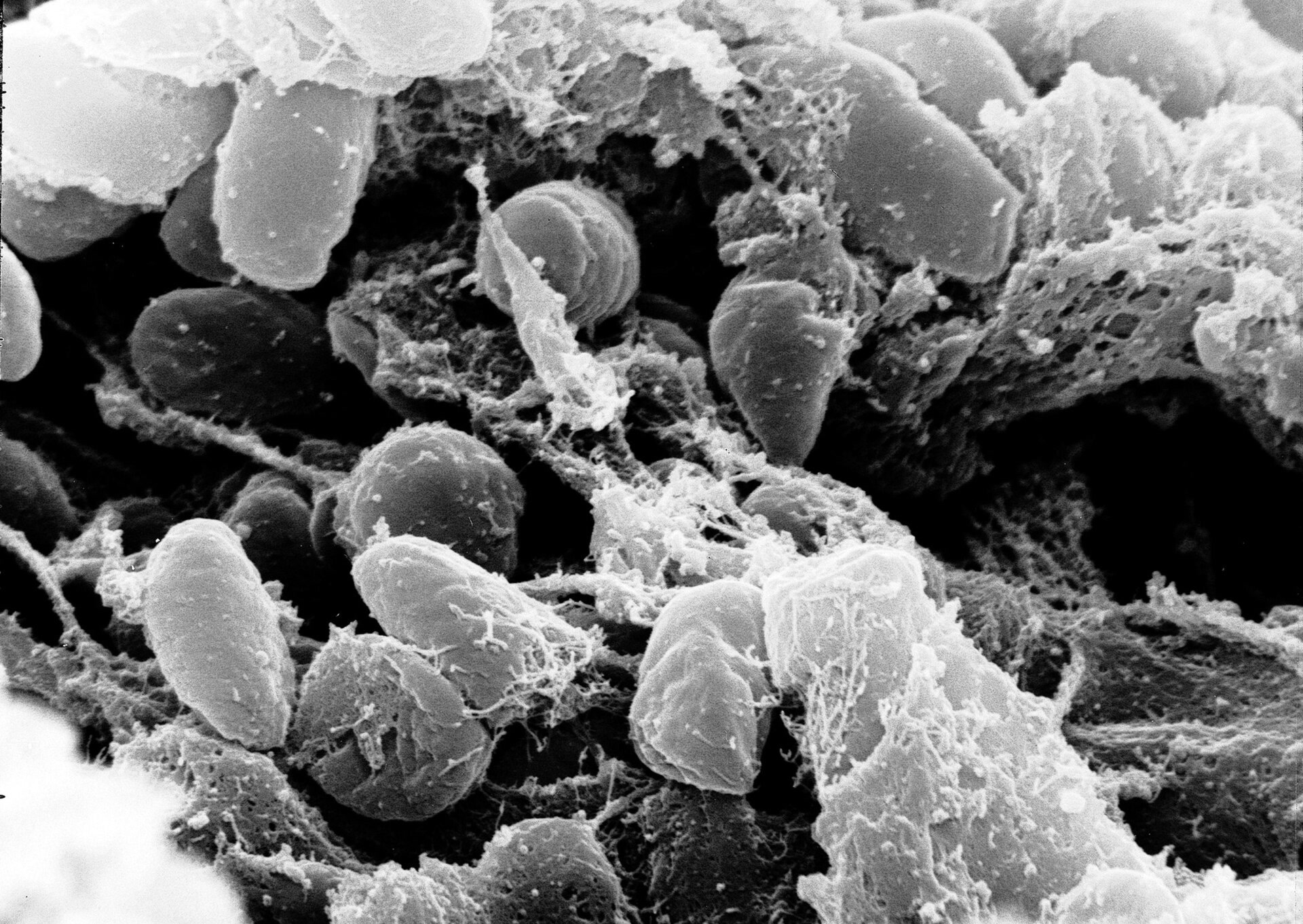 Бактерия Yersinia pestis, возбудитель чумы, под электронным микроскопом